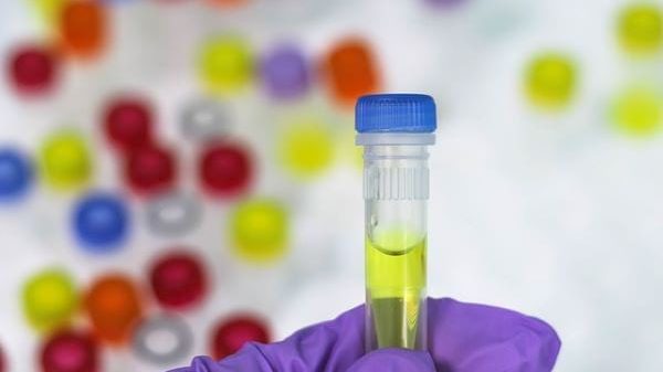 Drug Processing Timelines, ua drug testing